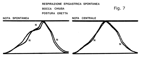 Respirazione Epigastrica spontanea